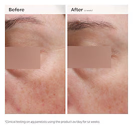 The Ordinary Niacinamide 5% Face & Body Emulsion - Yüz & Vücut Emülsiyonu 100 ml