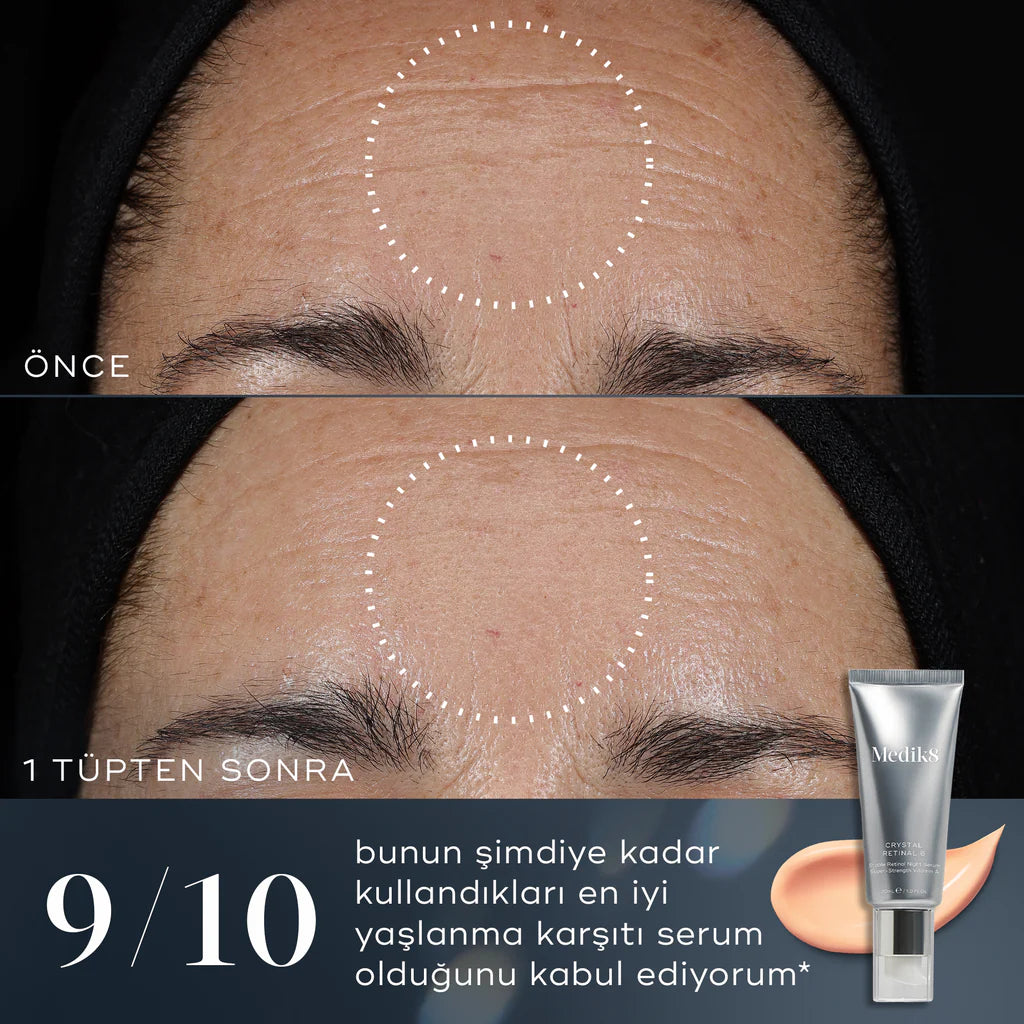 Crystal Retinal 6